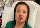 Iconic Model Permanently Disfigured in Shocking Incident
