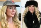 Brandi Glanville Unveils Stunning Transformation Following Facial Disfigurement