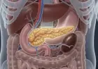 Triple Therapy May Revolutionize Pancreatic Cancer Treatment