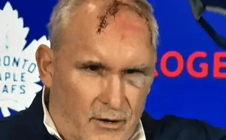 Leafs Coach Craig Berube Injured in Gym Accident: Head Cut, Eye Bruised