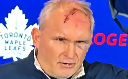 Berube Reveals Forehead Stitches from Gym Accident