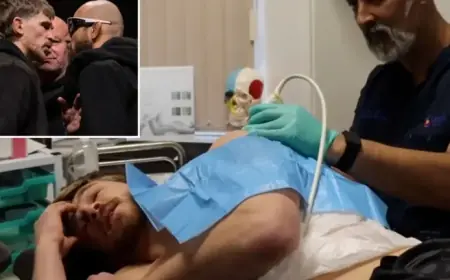 Arnold Allen Shares Mental Challenges During Injury Before UFC 324 vs. Jean Silva