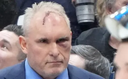 Craig Berube injury: Maple Leafs coach left with stitched forehead after gym accident