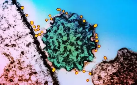 Nipah Virus Threat: No Vaccine, No Cure – Should We Be Concerned?