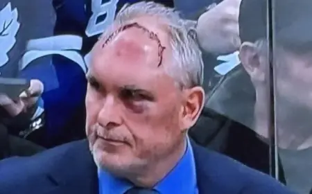 Craig Berube’s Head Injury: Maple Leafs Coach Shrugs Off “Bad” Gym Accident, Coaches Through Black Eye and Nearly 50 Stitches