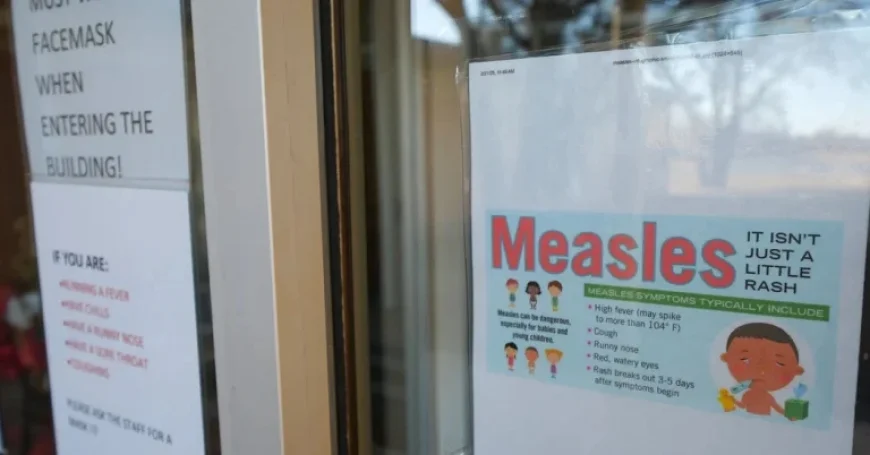 South Carolina Sees Surge in Measles Cases