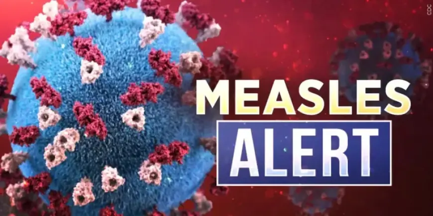 First Measles Case of 2026 Reported in Kentucky