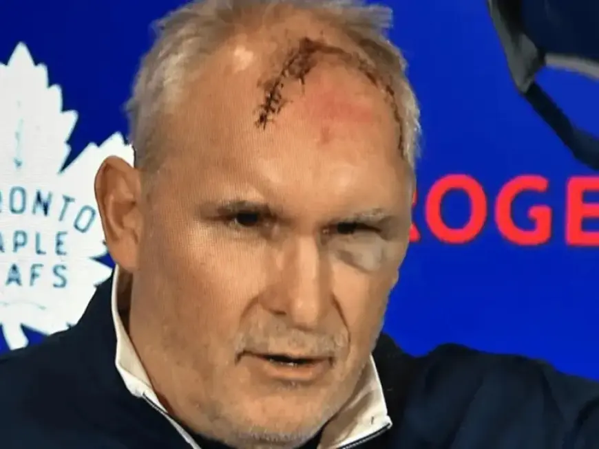 Leafs Coach Craig Berube Injured in Gym Accident: Head Cut, Eye Bruised