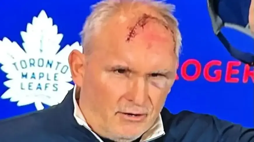 Berube Reveals Forehead Stitches After Gym Accident