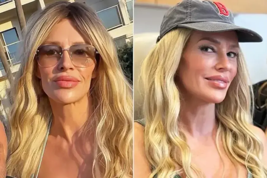 Brandi Glanville Unveils New Look Before Sundance, Credits Plastic Surgeon