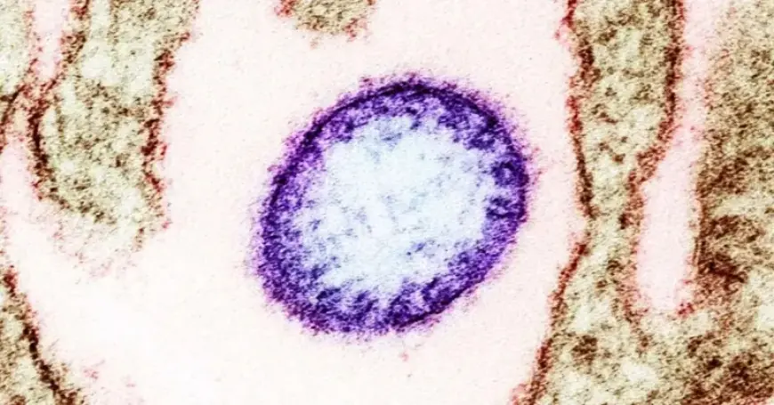 India Implements Airport Screenings Following Nipah Virus Outbreak Detection