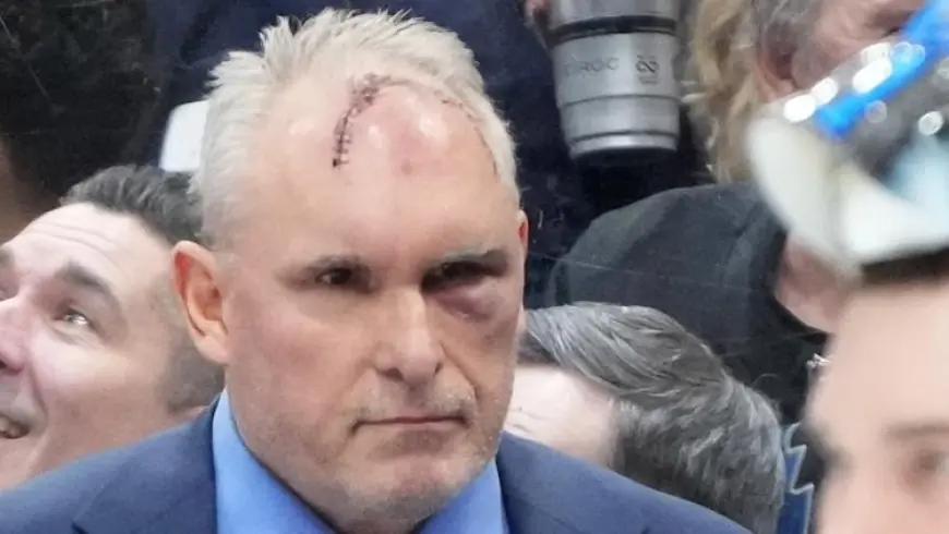 Craig Berube’s Head Injury: Maple Leafs Coach Reveals Gym Accident Behind the Stitches and Black Eye