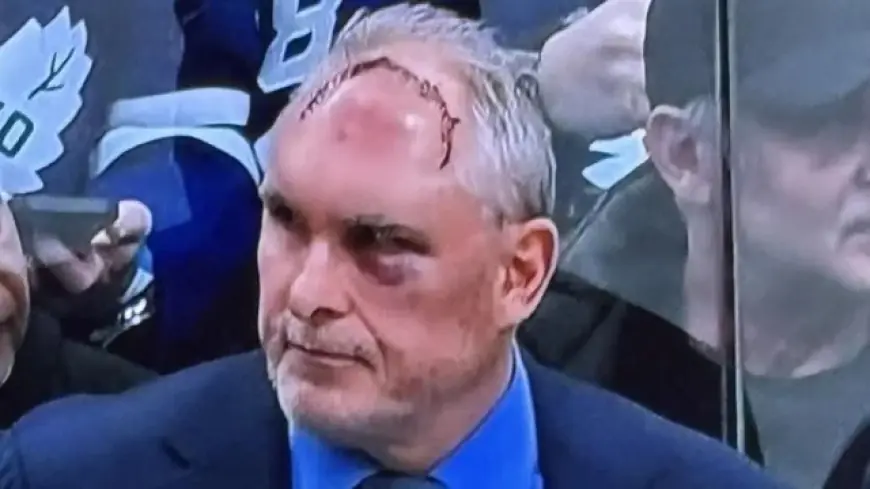 Craig Berube’s Head Injury: Maple Leafs Coach Shrugs Off “Bad” Gym Accident, Coaches Through Black Eye and Nearly 50 Stitches