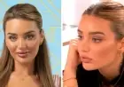 Lucinda’s Love Island Transformation: Before and After Cosmetic Treatments Unveiled