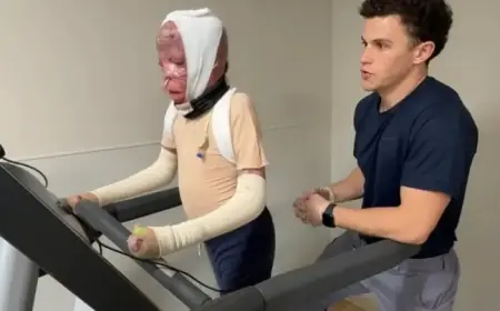 One Year After Fatal Crash, 10-Year-Old Ramesses’ Inspiring Recovery Journey