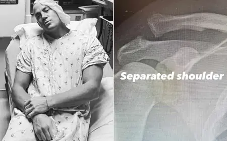 Channing Tatum Hospital Update: Shoulder Surgery Photos Spark Concern, Then Relief, After “Separated Shoulder” Reveal