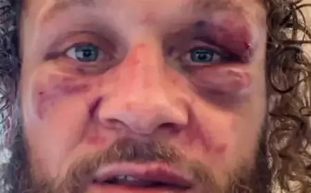 Rafael Fiziev Responds to UFC 325 Knockout Defeat by Mauricio Ruffy