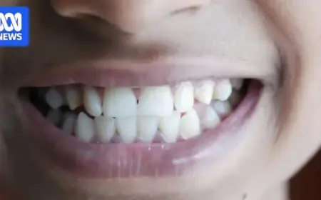 Teeth Unveil the Widening Wealth Gap