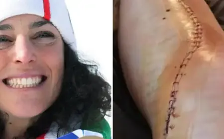 Brignone Returns 10 Months After Injury: Fall, Surgery, Recovery Explained