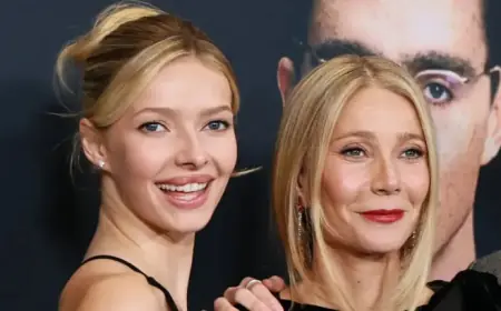 Apple Martin Unveils Her Sole Cosmetic Procedure in Celebrity News Update