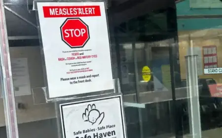 Measles Outbreak: Essential Information as Virus Spreads