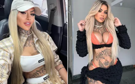 Influencer Bianca Dias Dies After Cosmetic Surgery Complications; Conflicting Details Emerge