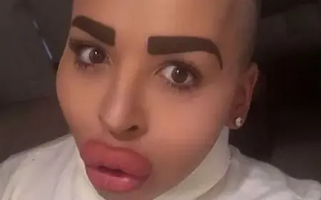 Jordan James Parke: jordan james parke, Britain's 'Lip King' dies