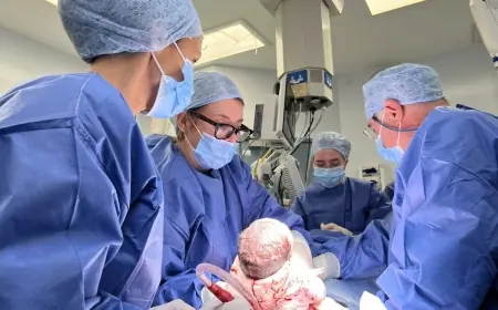 Baby Born Womb Transplant: baby born womb transplant milestone as Hugo arrives