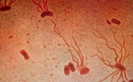 Xdr Typhi Research 2022 Finds Drug-Resistant Typhoid Strains Rising and Crossing Borders