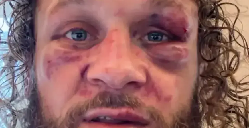 Rafael Fiziev Responds to UFC 325 Knockout Defeat by Mauricio Ruffy