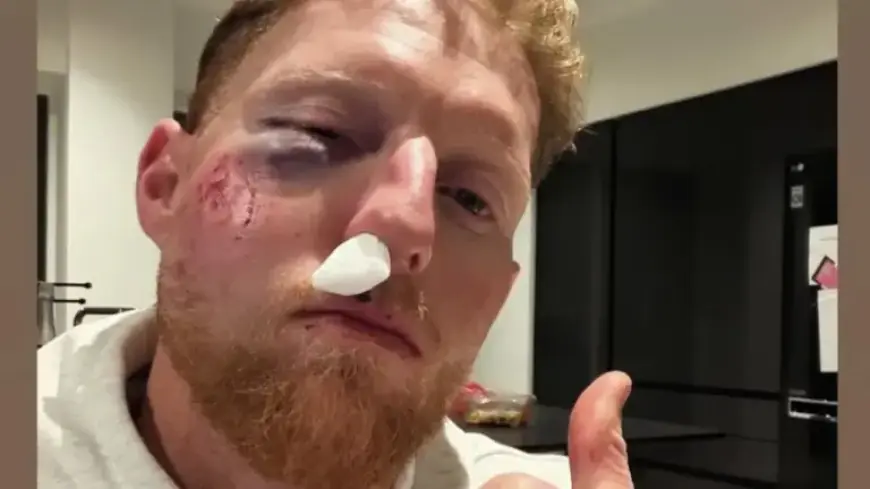 Stokes’ Severe Injury Raises Concerns