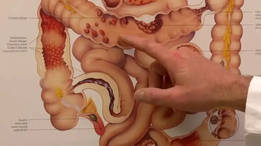 James Van Der Beek’s Passing Spurs Early Colorectal Cancer Screening Efforts