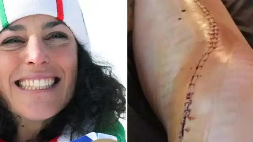 Brignone Returns 10 Months After Injury: Fall, Surgery, Recovery Explained