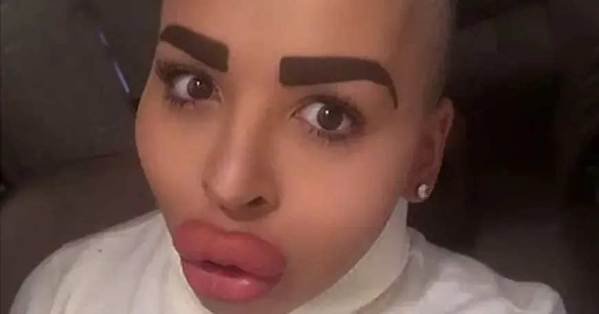 Jordan James Parke: jordan james parke, Britain's 'Lip King' dies