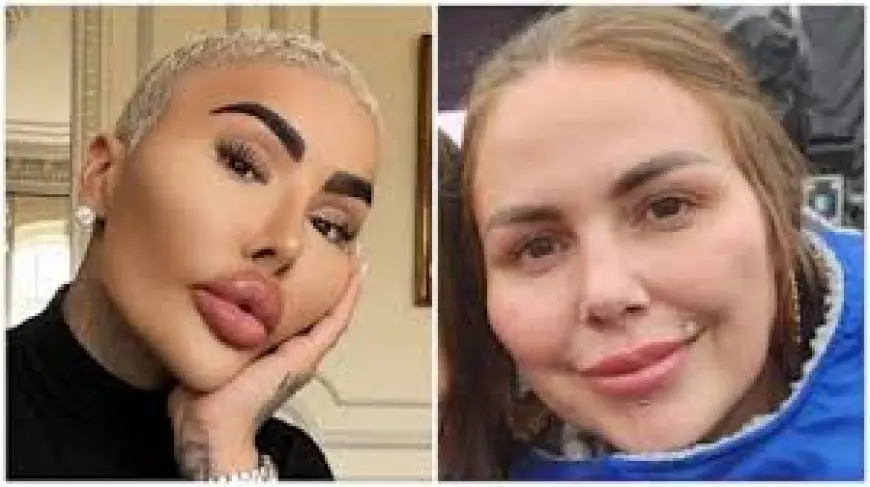 Two Arrested After Death of British Lip King at Canary Wharf as Police Probe Cosmetic Procedure