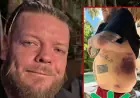 Corey Harrison Asks Fans to Help Pay Six-Figure Medical Bills After Tulum Motorcycle Crash