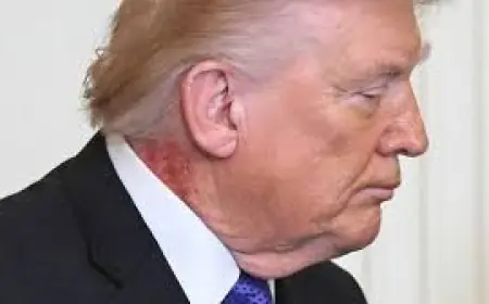 Trump Neck Rash Draws Scrutiny as White House Doctor Says Cream Caused Redness