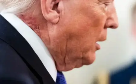 President Trump Attends Event Showing Noticeable Red Skin Rash