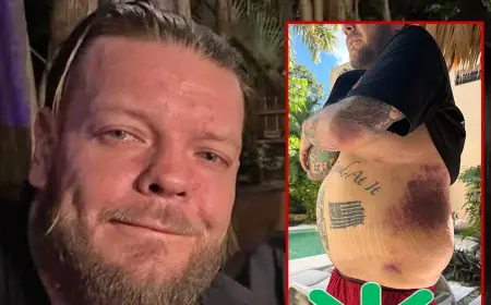 Corey Harrison Asks Fans to Help Pay Six-Figure Medical Bills After Tulum Motorcycle Crash