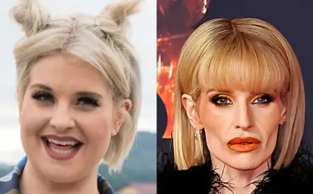 Kelly Osbourne Update Today — "I Am Ill Right Now": Friends Plead for Compassion as Body-Shaming Intensifies