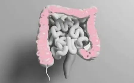 Colorectal rise under 50 highlights need to watch Colon Cancer Symptoms closely