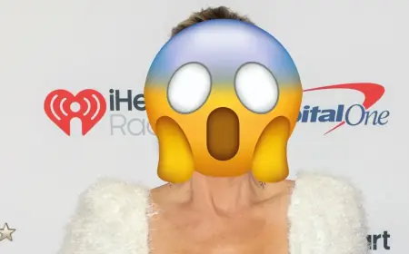 Alexis Bellino’s black eye post fuels concern as she insists it was an accident