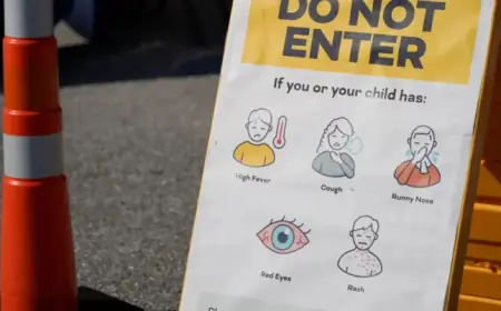 South Carolina Measles Outbreak Expected to End by April 26, Official Predicts