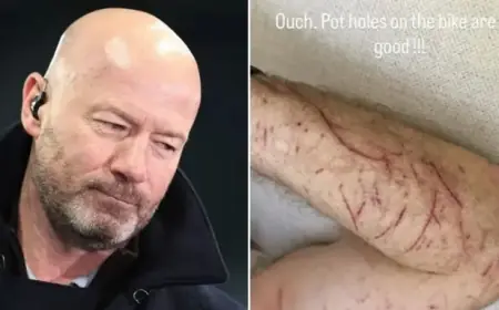 BBC’s Alan Shearer Injured in Serious Bike Crash After Hitting Pothole