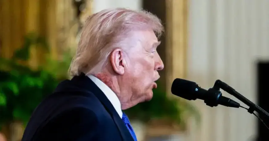 White House Responds to Redness on Trump’s Neck