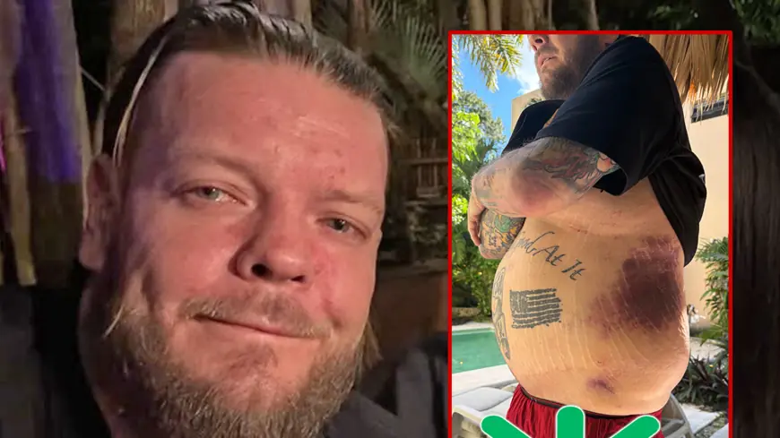 Corey Harrison Asks Fans to Help Pay Six-Figure Medical Bills After Tulum Motorcycle Crash