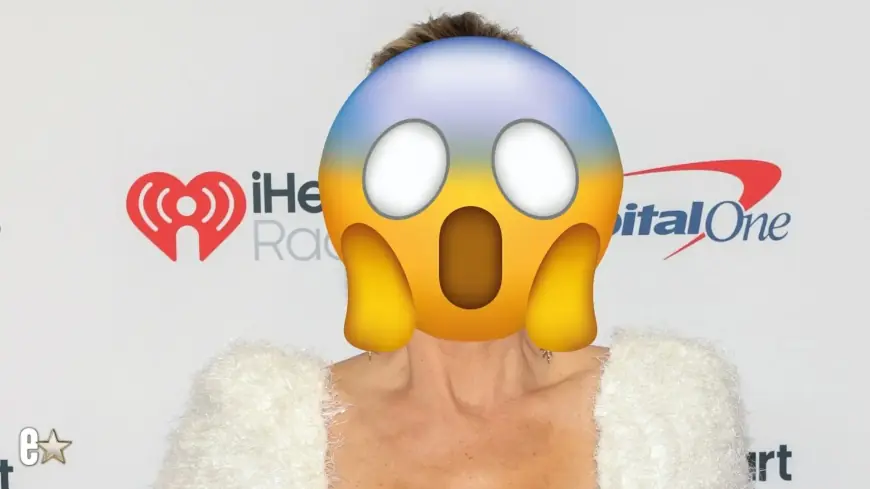 Alexis Bellino’s black eye post fuels concern as she insists it was an accident