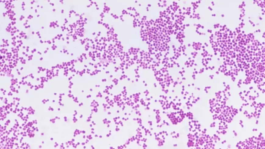 Meningitis Outbreak Kent: Two Dead and 11 Hospitalized as University and Schools Affected