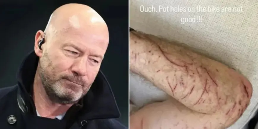 BBC’s Alan Shearer Injured in Serious Bike Crash After Hitting Pothole