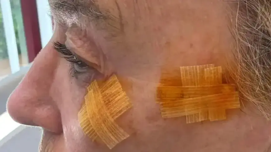 Scottish Olympic Legend Liz McColgan Warns of Health Risks After Facial Lesions Removed